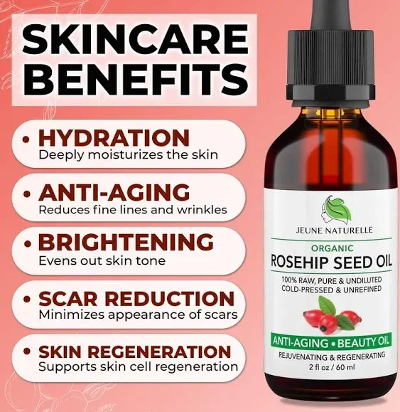 Rosehip Oil - 100% Pure RAW Organic, Virgin, Cold-Pressed, Unrefined for Anti Aging, Acne Eczema Wrinkles Dark Spots Scars Rosacea - Face Serum Oil - Anti Aging Beauty Rose Hip Oil, 2oz