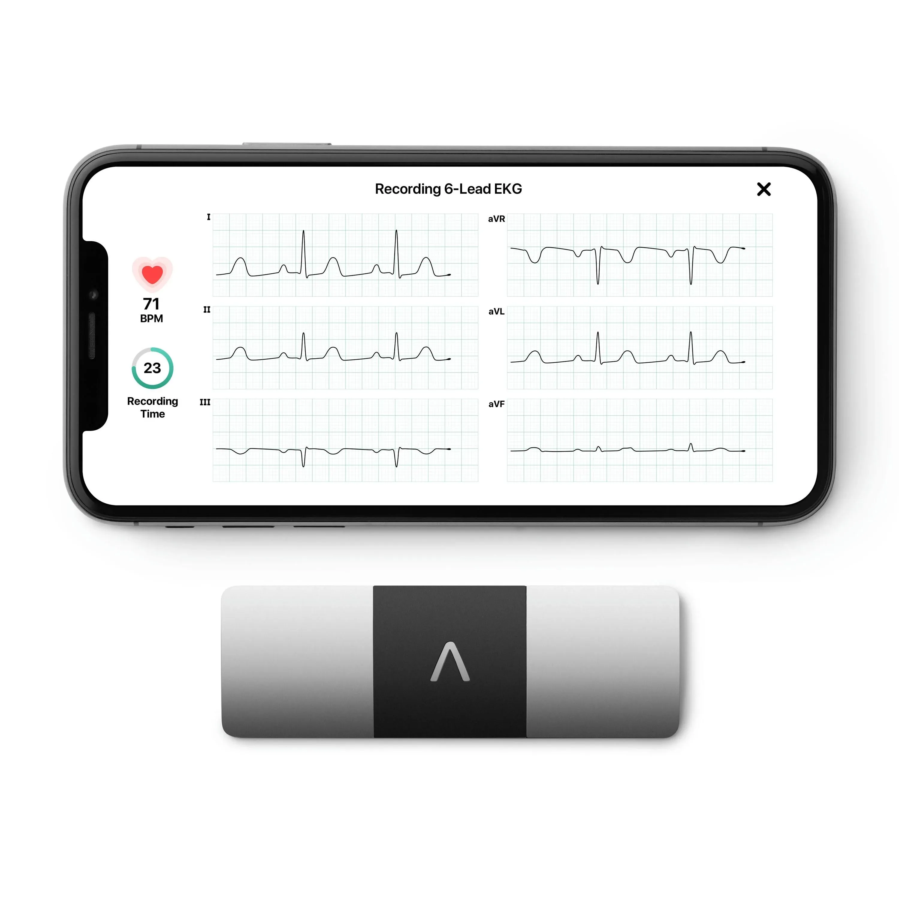 AliveCor Personal EKG Monitor