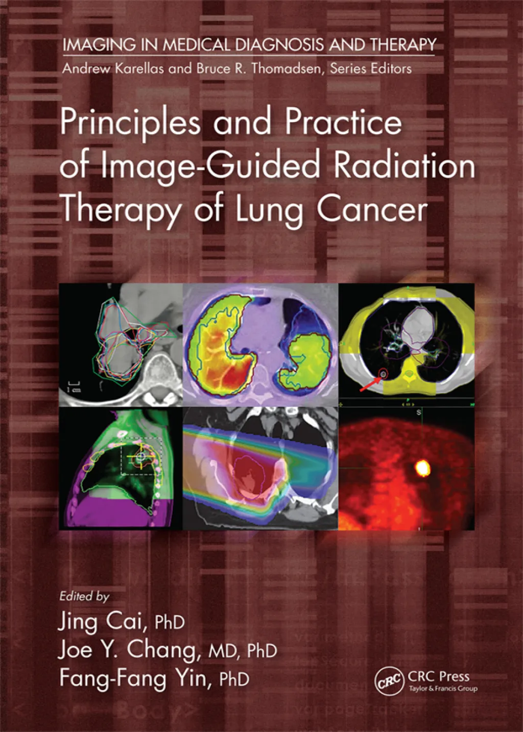 Principles and Practice of Image-Guided Radiation Therapy of Lung Cancer - 1st Edition (eBook Rental)